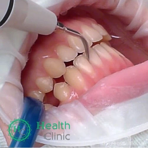 Клиника эстетической стоматологии Хелс Клиник Изображение 6