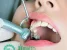 Клиника эстетической стоматологии Хелс Клиник Изображение 2