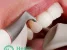 Клиника эстетической стоматологии Health Clinic Изображение 5